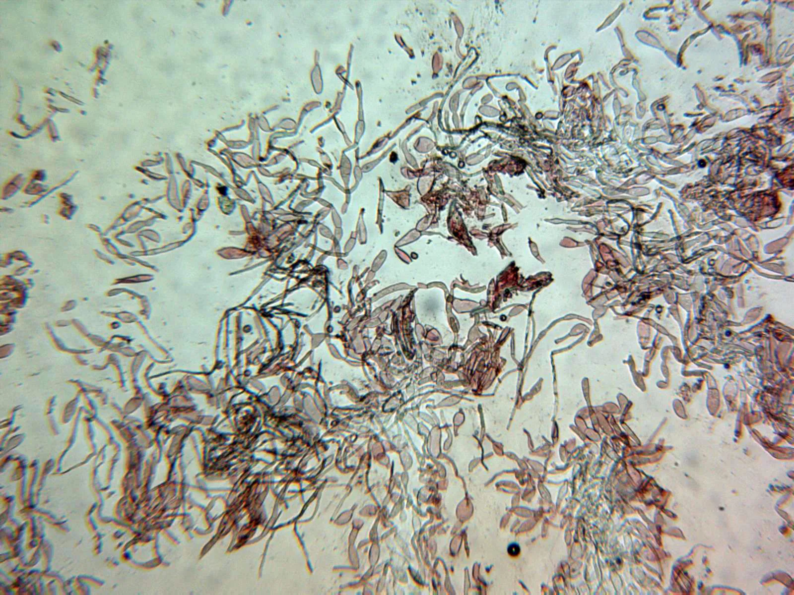 Microscopía de Russula chloroides - 11 - Pileipellis x 100